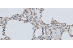 Immunohistochemistry of paraffin-embedded Rat lung using MMP1 Polyclonal Antibody at dilution of 1:50 (MMP1 Antikörper)
