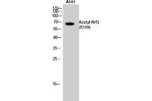 Western Blot analysis of A549 cells using Acetyl-Nrf2 (K599) Polyclonal Antibody. (NRF2 Antikörper  (acLys599))