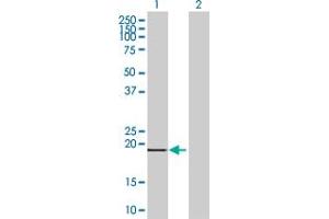 Lane 1: FTL transfected lysate ( 20 KDa). (FTL 293T Cell Transient Overexpression Lysate(Denatured))