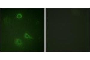 Immunofluorescence analysis of A549 cells, using NMDAR1 (Phospho-Ser890) Antibody. (GRIN1/NMDAR1 Antikörper  (pSer890))