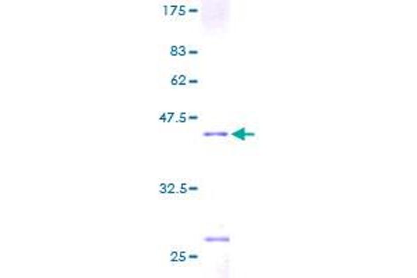 RPS14 Protein (AA 1-151) (GST tag)