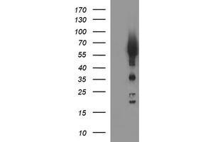 Image no. 1 for anti-Tyrosine Hydroxylase (TH) antibody (ABIN1501367) (Tyrosine Hydroxylase Antikörper)