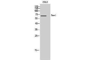 Western Blotting (WB) image for anti-Crossover junction endonuclease EME1 (EME1) (Internal Region) antibody (ABIN3174936) (Crossover junction endonuclease EME1 (EME1) (Internal Region) Antikörper)