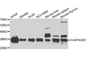 Western blot analysis of extracts of various cell lines using CASP3 antibody. (Caspase 3 Antikörper)