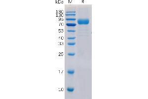 Human CD19 Protein, hFc-His Tag on SDS-PAGE under reducing condition. (CD19 Protein (AA 20-291) (Fc-His Tag))