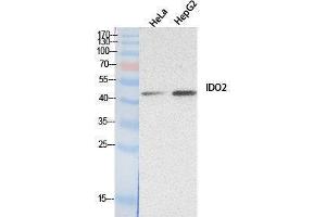 Western Blotting (WB) image for anti-Indoleamine 2,3-Dioxygenase 2 (IDO2) (Internal Region) antibody (ABIN6280734) (IDO2 Antikörper  (Internal Region))