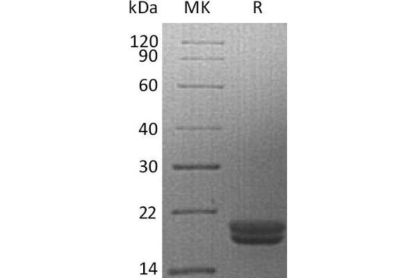 IL16 Protein