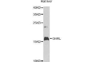 Western blot analysis of extracts of rat liver, using GHRL antibody (ABIN6292644) at 1:1000 dilution. (Ghrelin Antikörper)