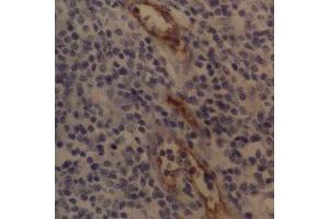 Immunohistochemistry (IHC) image for anti-Selectin P (Granule Membrane Protein 140kDa, Antigen CD62) (SELP) antibody (ABIN2472250) (P-Selectin Antikörper)