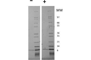 SDS-PAGE of Human Neuregulin 1-beta Recombinant Protein SDS-PAGE of Human Neuregulin 1-beta Recombinant Protein. (Neuregulin 1 Protein (NRG1))