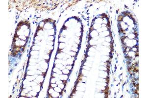 Immunohistochemistry of paraffin-embedded human colon using PP1 beta Rabbit mAb (ABIN1679819, ABIN3018859, ABIN3018860 and ABIN7101675) at dilution of 1:100 (40x lens). (PPP1CB Antikörper)