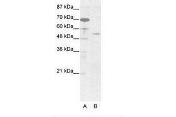 EVX2 Antikörper  (AA 63-112)