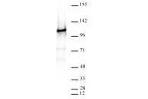 CTCF antibody (rAb) tested by Western blot. (Rekombinanter CTCF Antikörper)