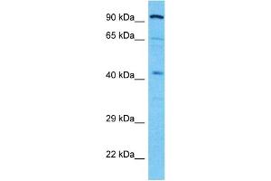 Host:  Rabbit  Target Name:  ALDOB  Sample Type:  721_B Whole Cell lysates  Antibody Dilution:  1. (ALDOB Antikörper  (N-Term))