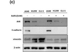 Western Blotting (WB) image for anti-Vimentin (VIM) antibody (ABIN2854814)