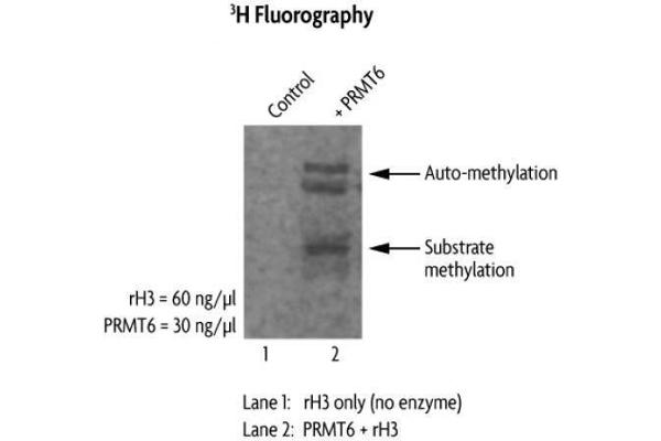 PRMT6 Protein (DYKDDDDK Tag)