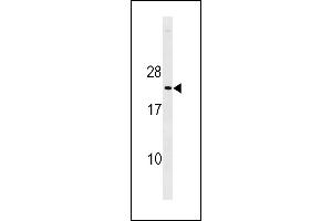 Mouse p27Kip1 Antibody (C-term ) (ABIN1881618 and ABIN2843237) western blot analysis in mouse heart tissue lysates (35 μg/lane). (CDKN1B Antikörper  (C-Term))