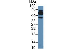 Detection of TNFb in Human Leukocyte lysate using Polyclonal Antibody to Tumor Necrosis Factor Beta (TNFb) (LTA Antikörper  (AA 49-202))