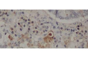 Immunohistochemistry of paraffin-embedded Rat lung using CD68 Polyclonal Antibody at dilution of 1:50 (CD68 Antikörper)