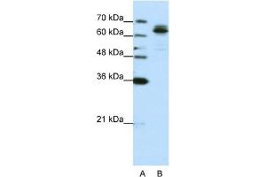WB Suggested Anti-FXR1 Antibody Titration:  0. (FXR1 Antikörper  (C-Term))