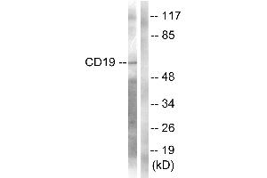 Western blot analysis of extracts from COS7 cells, treated with Serum (10%, 30mins), using CD19 (Ab-531) Antibody. (CD19 Antikörper  (Tyr531))