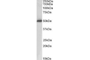 Western Blotting (WB) image for anti-Acid Phosphatase, Prostate (ACPP) antibody (ABIN5855941) (ACPP Antikörper)