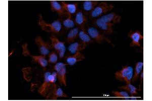 Immunofluorescence  staining of huSSECTM cell line overexpressing hFcRn-EGFP using  clone DVN24 at 15µg/ml and Texas Red™ conjugated anti-mouse secondary. (FcRn Antikörper)