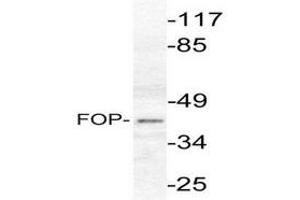 Image no. 1 for anti-FGFR1 Oncogene Partner (FGFR1OP) antibody (ABIN265416) (FGFR1OP Antikörper)