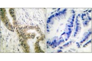 Immunohistochemistry (IHC) image for anti-Tumor Protein P53 (TP53) (acLys386) antibody (ABIN2890735) (p53 Antikörper  (acLys386))