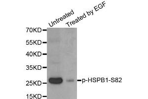 Western Blotting (WB) image for anti-Heat Shock 27kDa Protein 1 (HSPB1) (pSer82) antibody (ABIN1870246) (HSP27 Antikörper  (pSer82))