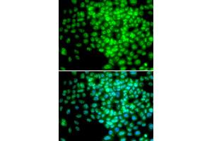 Immunofluorescence analysis of HeLa cells using POLR2F antibody. (POLR2F Antikörper)