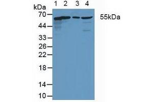 Western blot analysis of (1) Human HeLa cells, (2) Rat Heart Tissue, (3) Rat Intestine Tissue and (4) Rat Brain Tissue. (Coxsackie Adenovirus Receptor Antikörper  (AA 20-229))