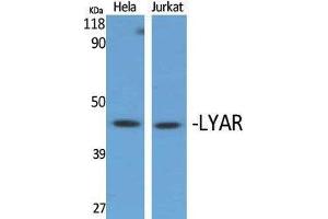 Western Blotting (WB) image for anti-Ly1 Antibody Reactive (LYAR) (Internal Region) antibody (ABIN3185425) (LYAR Antikörper  (Internal Region))