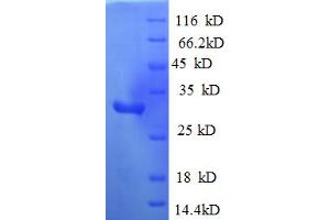 SDS-PAGE (SDS) image for Mitogen-Activated Protein Kinase Kinase Kinase 1 (MAP3K1) (AA 1216-1493), (partial) protein (His tag) (ABIN5712968) (MAP3K1 Protein (AA 1216-1493, partial) (His tag))