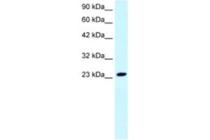 Western Blotting (WB) image for anti-FLJ11730 antibody (ABIN2460699) (FLJ11730 Antikörper)