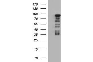 Image no. 1 for anti-Forkhead Box P1 (FOXP1) antibody (ABIN1498299) (FOXP1 Antikörper)