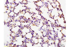 Immunohistochemistry (Paraffin-embedded Sections) (IHC (p)) image for anti-Coagulation Factor III (thromboplastin, Tissue Factor) (F3) (AA 32-100) antibody (ABIN708086)