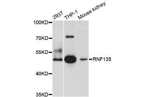 Western blot analysis of extracts of various cell lines, using RNF135 antibody (ABIN5996007) at 1/1000 dilution. (RNF135 Antikörper)