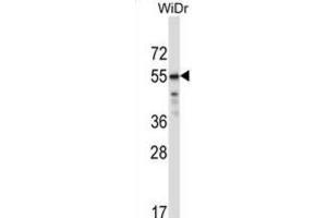 Western Blotting (WB) image for anti-Transcription Factor CP2-Like 1 (TFCP2L1) antibody (ABIN2997307) (TFCP2L1 Antikörper)