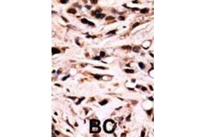 Immunohistochemistry (IHC) image for anti-SMAD Family Member 4 (SMAD4) (pThr277) antibody (ABIN3001788) (SMAD4 Antikörper  (pThr277))