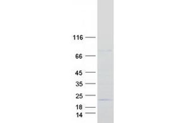 Proline Rich 13 Protein (PRR13) (Transcript Variant 2) (Myc-DYKDDDDK Tag)