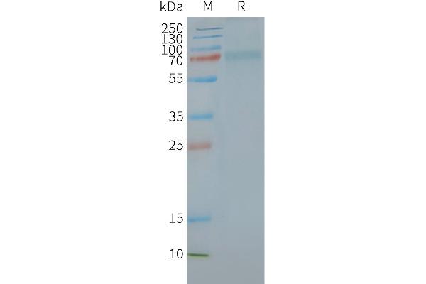 CALCRL Protein