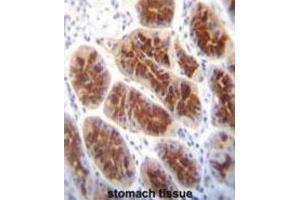 Immunohistochemistry (IHC) image for anti-Claudin 2 (CLDN2) antibody (ABIN2996861) (Claudin 2 Antikörper)