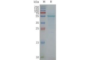 Human T-Nanodisc, Flag Tag on SDS-PAGE (TMCC3 Protein)