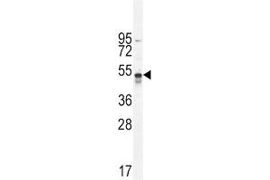 Western Blotting (WB) image for anti-TNFR-S274 antibody (ABIN2996049) (TNFR-S274 Antikörper)