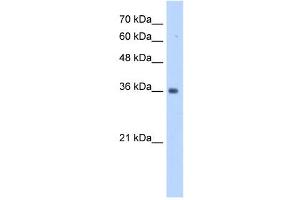 TRUB2 antibody used at 1 ug/ml to detect target protein. (TRUB2 Antikörper  (N-Term))