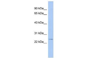 WB Suggested Anti-EVI2A Antibody Titration:  0. (EVI2A Antikörper  (C-Term))