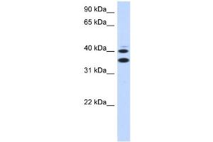 WB Suggested Anti-SLC25A32 Antibody Titration:  0. (SLC25A32 Antikörper  (Middle Region))