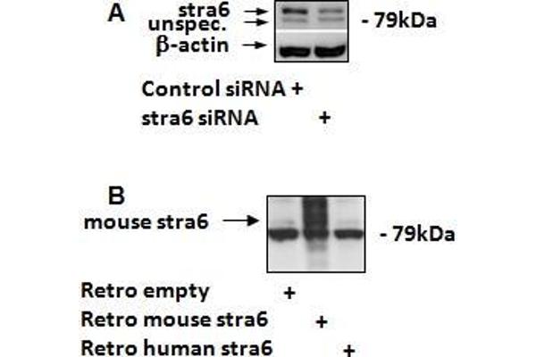 STRA6 Antikörper  (C-Term)