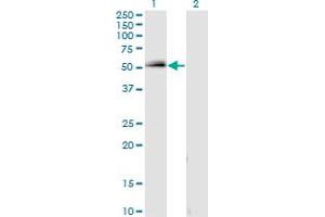 Western Blot analysis of SPP1 expression in transfected 293T cell line by SPP1 monoclonal antibody (M16), clone 1D7. (Osteopontin Antikörper  (AA 21-129))